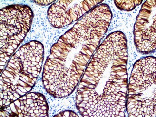 IHC of Cytokeratin 18 on an FFPE Colon Tissue